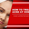 How to treat acne at home